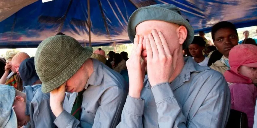 Albinism association urges Nigerian government to include skin cancer in health insurance