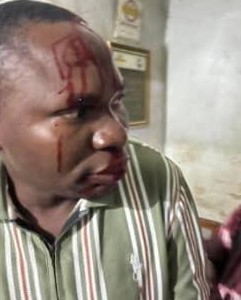 Relative stabs Federal Medical Centre staff over patient’s death, union begins strike in protest